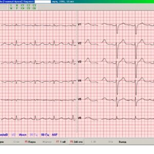 Программное обеспечение ArMaSoft-12-Cardio